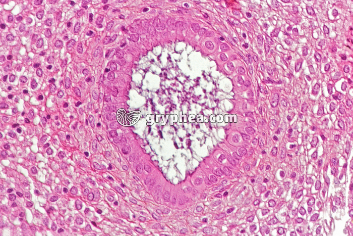 Endomètre sécrétoire x100 - gryphea.com